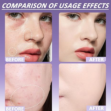 🔥BUY 1 GET 1 FREE (2 PCS)🔥 Soft Matte Cream Concealer