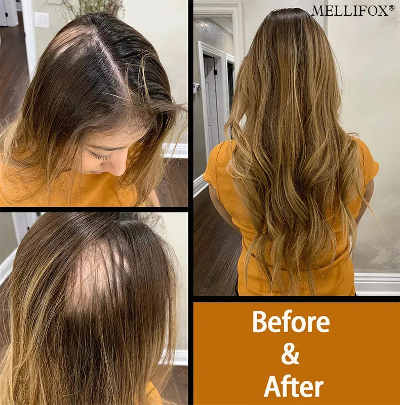 🔥Each $1.49 On Sale Today Only🎁Frienddyshop®Virgin Human Hair Seamless Tape-In Extensions-20pieces